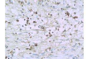 Formalin-fixed and paraffin embedded mouse enterocolitis labeled with Anti-IL-32/NK4 Polyclonal Antibody, Unconjugated (ABIN748298) followed by conjugation to the secondary antibody and DAB staining (IL32 抗体  (AA 151-234))