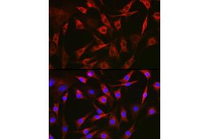 Immunofluorescence analysis of NIH-3T3 cells using FAK Rabbit pAb (ABIN6131638, ABIN6146424, ABIN6146426 and ABIN6215254) at dilution of 1:100 (40x lens). (FAK 抗体  (AA 425-660))
