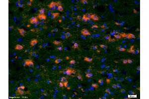 Formalin-fixed and paraffin-embedded rat brain labeled with Anti-CCDC12 Polyclonal Antibody, Unconjugated (ABIN872486) 1:200, overnight at 4°C, The secondary antibody was Goat Anti-Rabbit IgG, Cy3 conjugated used at 1:200 dilution for 40 minutes at 37°C. (CCDC12 抗体  (AA 19-120))