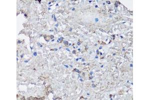 Immunohistochemistry of paraffin-embedded Human lung using NLRC4 Polyclonal Antibody at dilution of 1:100 (40x lens). (NLRC4 抗体)