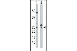 The anti-UCK Pab (ABIN392730 and ABIN2842193) is used in Western blot to detect UCK in mouse cerebellum tissue lysate (Lane 1) and HepG2 cell lysate (Lane 2).
