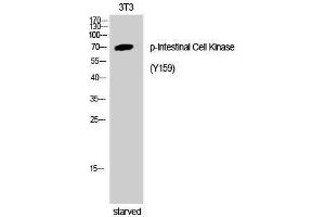 Western Blotting (WB) image for anti-Intestinal Cell (MAK-Like) Kinase (ICK) (pTyr159) antibody (ABIN3173080) (ICK 抗体  (pTyr159))