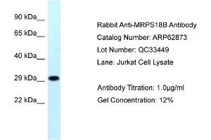 Western Blotting (WB) image for anti-Mitochondrial Ribosomal Protein S18B (MRPS18B) (N-Term) antibody (ABIN2774354) (MRPS18B 抗体  (N-Term))