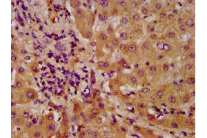 IHC image of ABIN7143530 diluted at 1:600 and staining in paraffin-embedded human liver tissue performed on a Leica BondTM system.