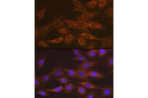 Immunofluorescence analysis of C6 cells using IMPDH2 Rabbit mAb  at dilution of 1:100 (40x lens). (IMPDH2 抗体)