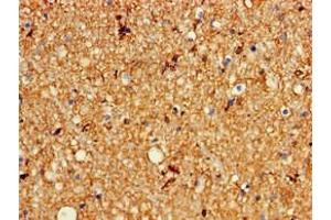 Immunohistochemistry of paraffin-embedded human brain tissue using ABIN7163965 at dilution of 1:100 (KCNC1 抗体  (AA 1-190))