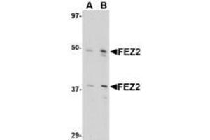 Image no. 1 for anti-Fasciculation and Elongation Protein zeta 2 (Zygin II) (FEZ2) (Internal Region) antibody (ABIN1493789) (FEZ2 抗体  (Internal Region))