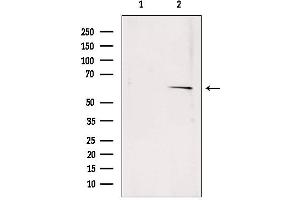Western blot analysis of extracts from rat muscle, using SQLE antibody. (SQLE 抗体  (C-Term))