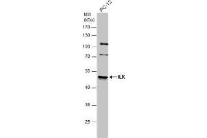 WB Image Whole cell extract (30 μg) was separated by 10% SDS-PAGE, and the membrane was blotted with ILK antibody [N1C1] , diluted at 1:500.