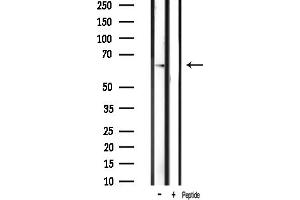 Western blot analysis of PAK1 phosphorylation expression in mouse brain tissue lysates,The lane on the right was treated with the antigen-specific peptide.