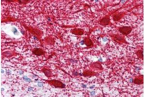 Human Brain, Cortex (formalin-fixed, paraffin-embedded) stained with MAP2 antibody ABIN239820 at 10 ug/ml followed by biotinylated anti-mouse IgG secondary antibody ABIN481714, alkaline phosphatase-streptavidin and chromogen. (MAP2 抗体  (AA 1375-1395))