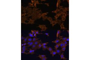 Immunofluorescence (IF) image for anti-Platelet Derived Growth Factor Receptor beta (PDGFRB) (AA 887-1106) antibody (ABIN3023139)