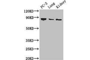 Western Blot Positive WB detected in: PC-3 whole cell lysate, Mouse lung tissue, Mouse kidney tissue All lanes: CARS antibody at 3 μg/mL Secondary Goat polyclonal to rabbit IgG at 1/50000 dilution Predicted band size: 86, 83, 95 kDa Observed band size: 86 kDa (CARS 抗体  (AA 201-500))