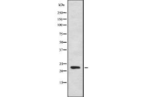 Western blot analysis of CYB561D1 using HeLa whole cell lysates (CYB561D1 抗体  (C-Term))