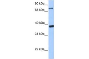 Western Blotting (WB) image for anti-Death Inducer-Obliterator 1 (DIDO1) antibody (ABIN2461923) (DIDO1 抗体)