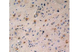 Used in DAB staining on fromalin fixed paraffin- embedded glioma tissue (RENBP 抗体  (AA 1-254))