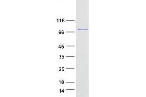 Western Blotting (WB) image for EF-Hand Domain (C-terminal) Containing 1 (EFHC1) protein (Myc-DYKDDDDK Tag) (ABIN2719959)