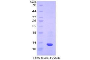 SDS-PAGE analysis of Cow Caspase 6 Protein. (Caspase 6 蛋白)