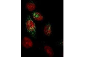 Immunofluorescence (IF) image for anti-Cytokeratin-2P (KRT76) antibody (ABIN6941415)