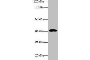 Western blot All lanes: CCDC24 antibody at 6 μg/mL + MCF-7 whole cell lysate Secondary Goat polyclonal to rabbit IgG at 1/10000 dilution Predicted band size: 35, 31 kDa Observed band size: 35 kDa (CCDC24 抗体  (AA 1-307))