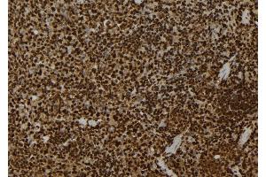 ABIN6272267 at 1/100 staining Mouse spleen tissue by IHC-P. (Casein Kinase 1 gamma 2 抗体  (C-Term))