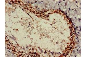 Immunohistochemistry of paraffin-embedded human lung tissue using ABIN7167768 at dilution of 1:100 (ALDH1A2 抗体  (AA 1-518))