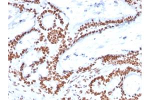 Immunohistochemistry (IHC) image for anti-Mismatch Repair Protein 2 (MSH2) (AA 327-427) antibody (ABIN6940081)