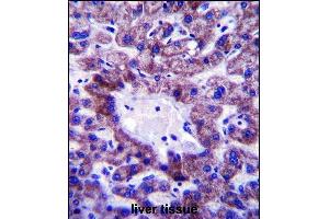 C5orf33 Antibody (Center) (ABIN657726 and ABIN2846712) immunohistochemistry analysis in formalin fixed and paraffin embedded human liver tissue followed by peroxidase conjugation of the secondary antibody and DAB staining. (NADK2 抗体  (AA 122-150))
