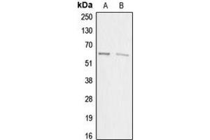 Western blot analysis of ACRBP expression in HEK293T (A), HeLa (B) whole cell lysates.