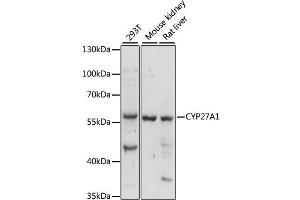 Western blot analysis of extracts of various cell lines, using CYP27 antibody (982) at 1:1000 dilution. (CYP27A1 抗体  (AA 200-400))