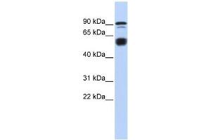 BCL11A antibody used at 0. (BCL11A 抗体  (N-Term))