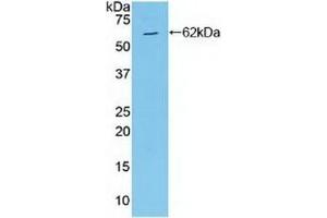 Detection of Recombinant MAP2K4, Human using Polyclonal Antibody to Mitogen Activated Protein Kinase Kinase 4 (MAP2K4) (MAP2K4 抗体  (AA 137-394))