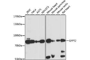 Western blot analysis of extracts of various cell lines, using GFPT2 antibody (ABIN7267431) at 1:1000 dilution.