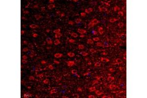 Immunofluorescence of paraffin embedded mouse corpus striatum using VIRL2 (ABIN7076206) at dilution of 1: 700 (400x lens) (VN1R2 抗体)