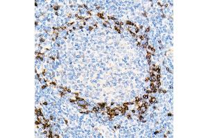 Immunohistochemistry of paraffin-embedded Human tonsil using IGHD antibody (ABIN7267824) at dilution of 1:100 (40x lens). (IgD 抗体)