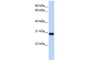 BPGM antibody used at 1 ug/ml to detect target protein. (BPGM 抗体  (Middle Region))