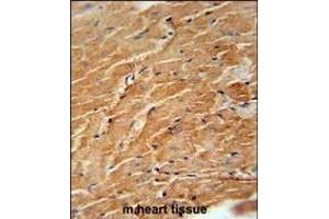 CCL21 Antibody (Center) (ABIN654093 and ABIN2843979) immunohistochemistry analysis in formalin fixed and paraffin embedded mouse heart tissue followed by peroxidase conjugation of the secondary antibody and DAB staining. (CCL21 抗体  (AA 23-52))