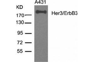 Image no. 3 for anti-Receptor Tyrosine-Protein Kinase ErbB-3 (ERBB3) (AA 1326-1330) antibody (ABIN319384) (ERBB3 抗体  (AA 1326-1330))