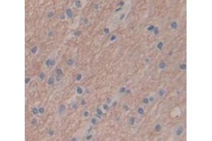IHC-P analysis of Human Tissue, with DAB staining. (SFRP4 抗体  (AA 265-346))