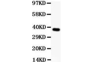 Anti-SynCAM Picoband antibody,  All lanes: Anti SYNCAM  at 0. (CADM1 抗体  (AA 45-340))