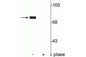 Western blot of rat cortical lysate showing specific immunolabeling of  the ~78 kDa synapsin I phosphorylated at Ser9 in the first lane (-). (SYN1 抗体  (pSer9))
