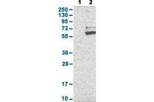 Western Blot analysis with RNF149 polyclonal antibody . (RNF149 抗体  (AA 250-383))