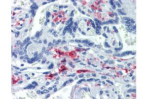 Anti-CD163 antibody IHC of human placenta.