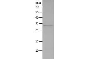 Western Blotting (WB) image for Myosin 9 (MYH9) (AA 2-241) protein (His tag) (ABIN7124191)