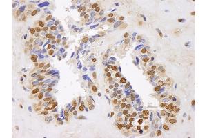Immunohistochemistry (IHC) image for anti-Glyceraldehyde-3-Phosphate Dehydrogenase (GAPDH) (AA 250-300) antibody (ABIN7448576)