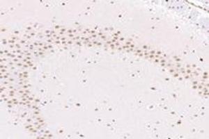 Immunohistochemistry analysis of paraffin-embedded mouse substantia nigra using NUP133 (ABIN7074909) at dilution of 1: 4800 (NUP133 抗体)