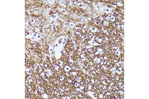 Immunohistochemistry of paraffin-embedded mouse spinal cord using CNTN1 antibody (ABIN7266492) at dilution of 1:100 (40x lens). (Contactin 1 抗体  (AA 250-350))
