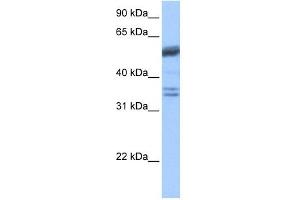 Coilin antibody used at 1 ug/ml to detect target protein. (Coilin 抗体  (C-Term))