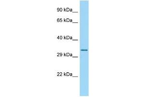 Host: Rabbit Target Name: RPS4Y2 Sample Type: 293T Whole Cell lysates Antibody Dilution: 1. (RPS4Y2 抗体  (C-Term))