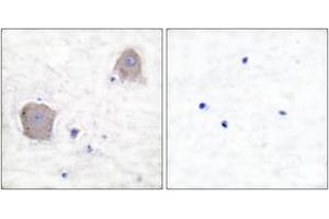 Immunohistochemistry analysis of paraffin-embedded human brain tissue, using mGluR4 Antibody. (Metabotropic Glutamate Receptor 4 抗体  (AA 851-900))